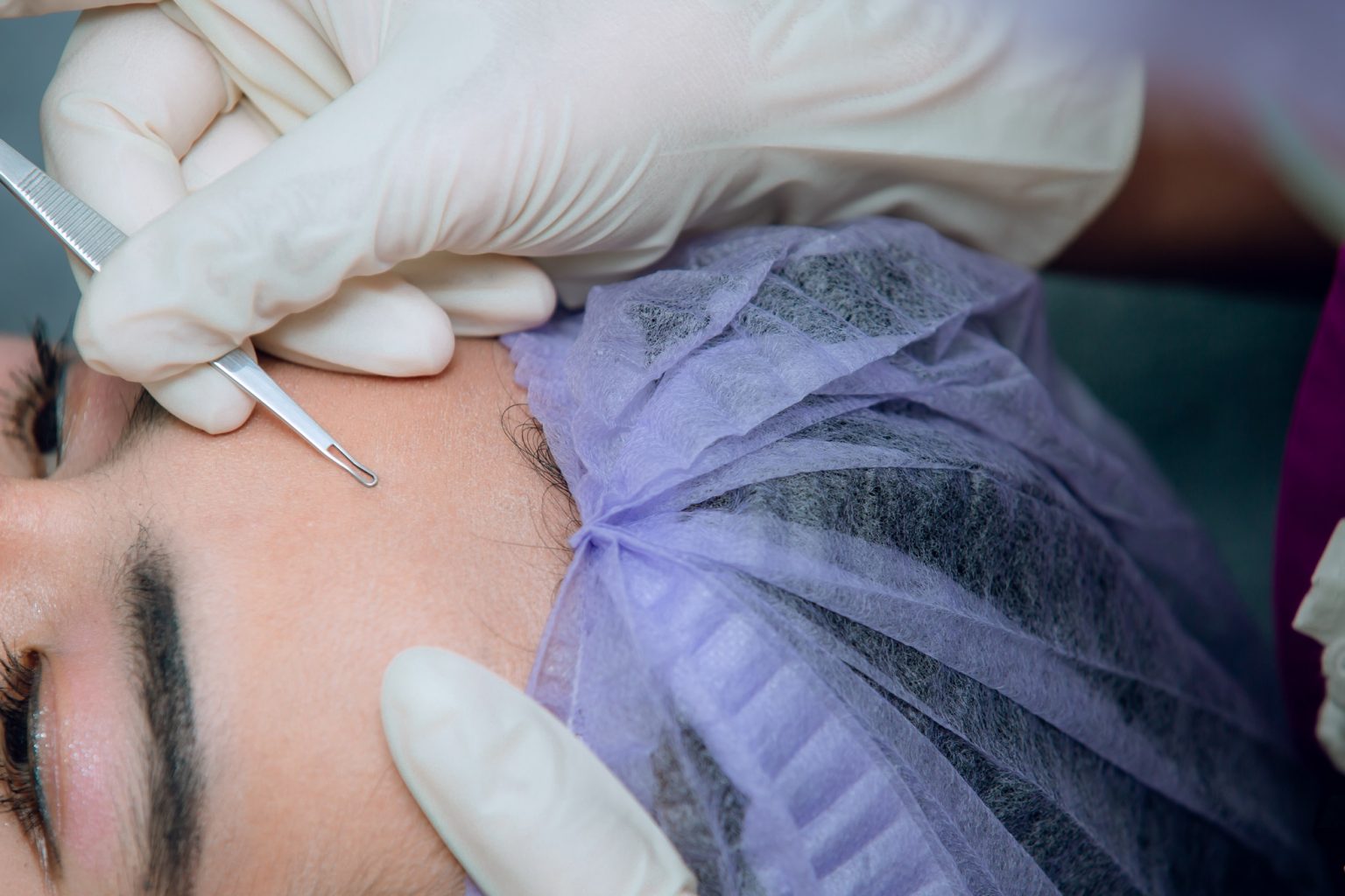 คลินิกรักษาโรคผิวหนังDS-Clinic1 (83)